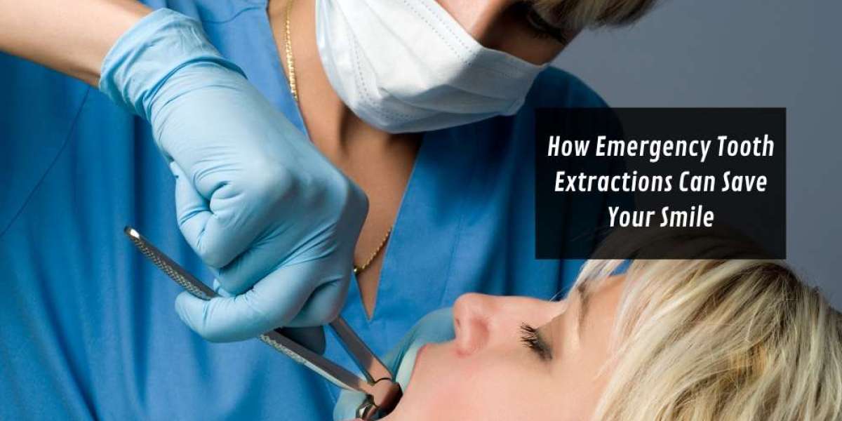 How Emergency Tooth Extractions Can Save Your Smile