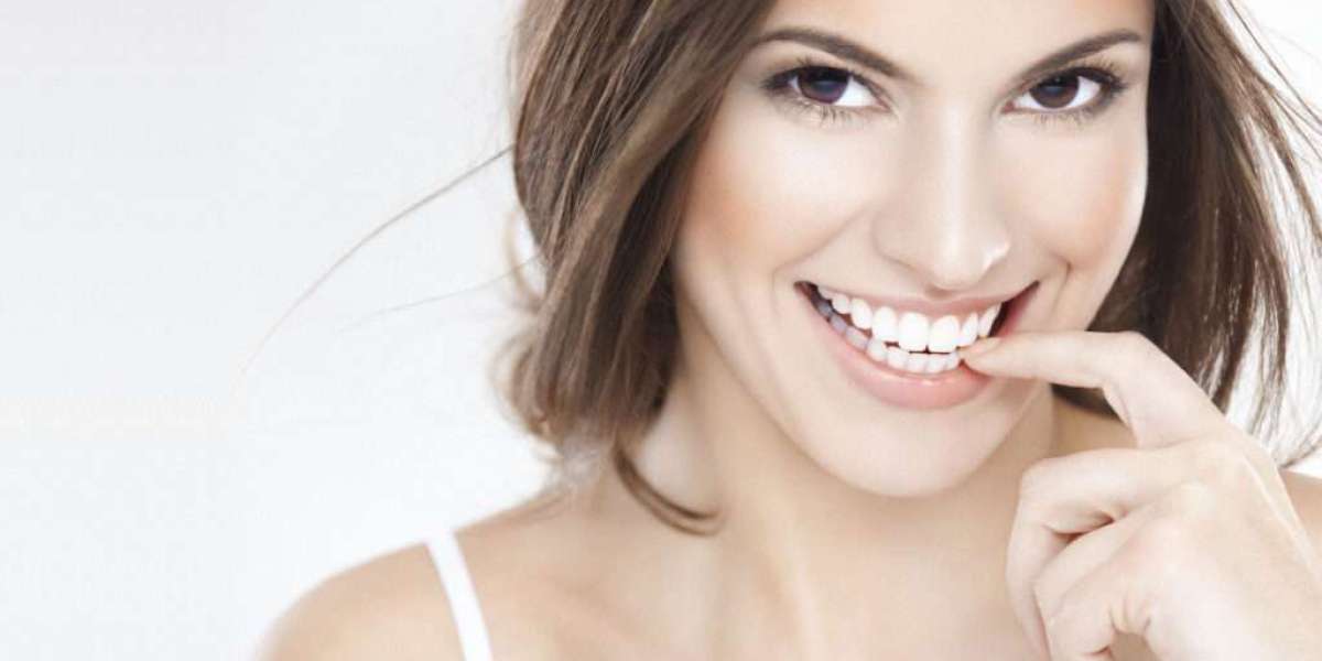 Quick Fix for Chipped Teeth: E-max Veneers Explained