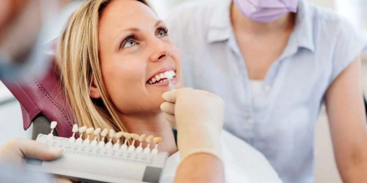 Your Instant Smile Upgrade: Why Veneers Deliver Immediate Results