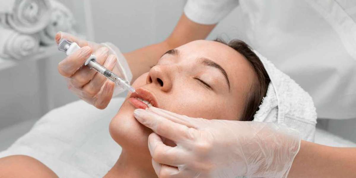 Can You Combine Belotero Fillers with Skincare Products?