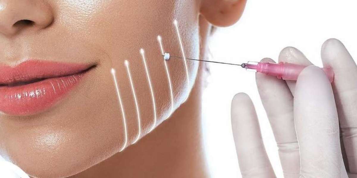 Lifting Without Surgery: Why Thread Lifts Are Trending