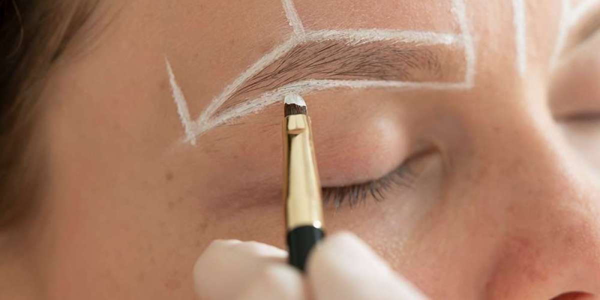 Everything You Should Know Before Getting an Eyebrow Transplant