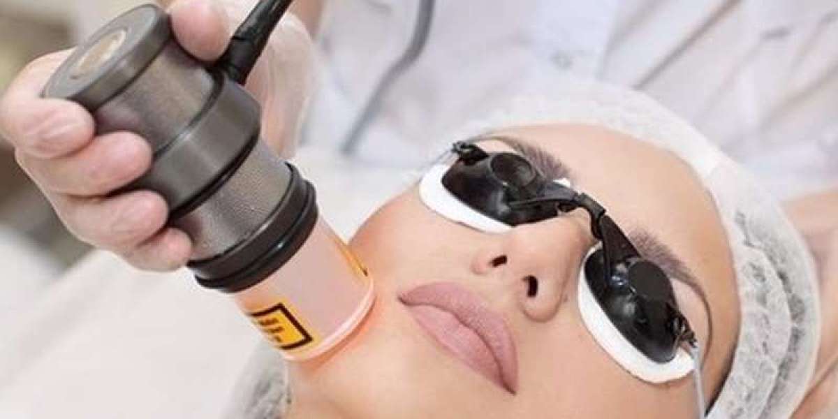 Laser Hair Removal for Men: Growing Trend in Grooming
