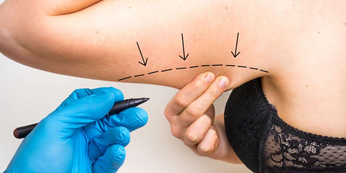 How Do I Choose the Right Type of Arm Lift in Dubai for My Body Type?
