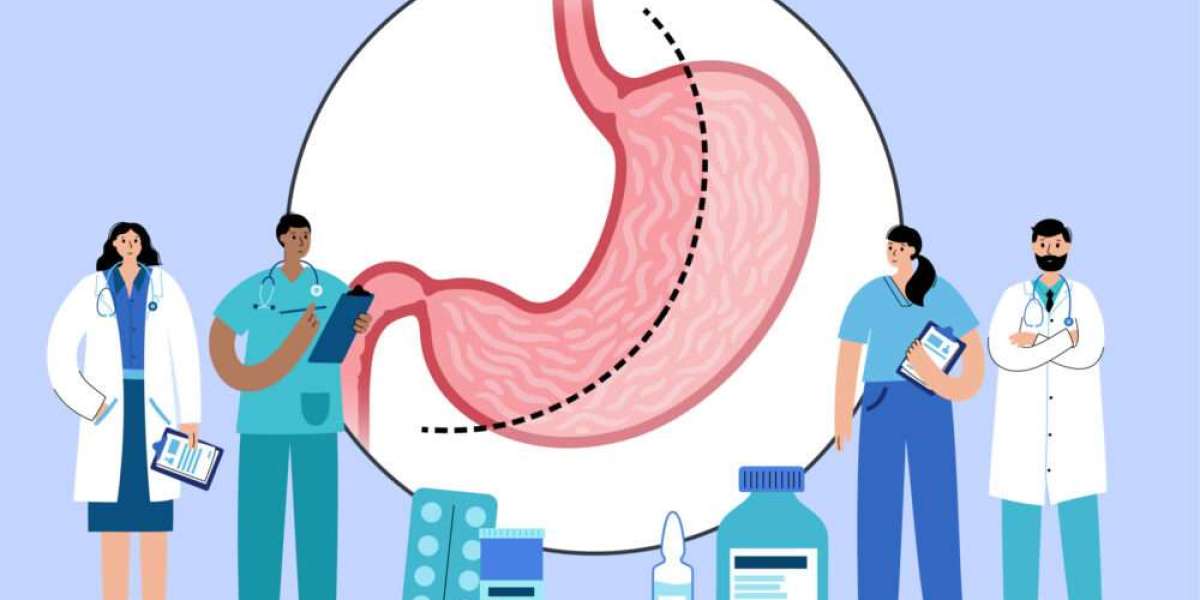 Gastric Bypass vs. Sleeve Gastrectomy: Which Is Right for You?