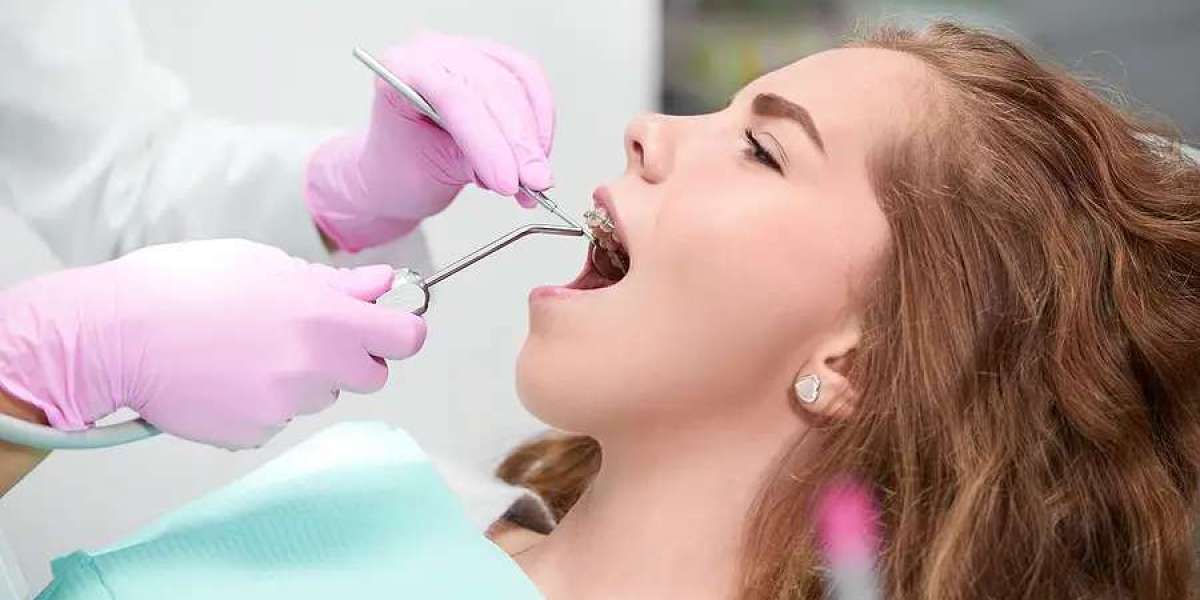 The Psychology Behind a Perfect Smile