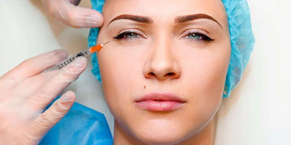 Sculptra vs. Traditional Fillers: Key Differences You Should Know