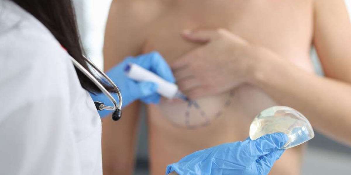 Understanding the Cost of Breast Augmentation in Islamabad
