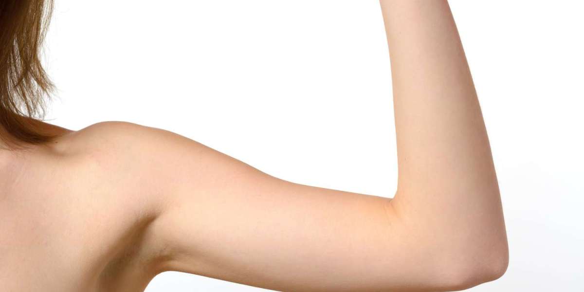 Are Arm Lifts Covered by Insurance? When and Why