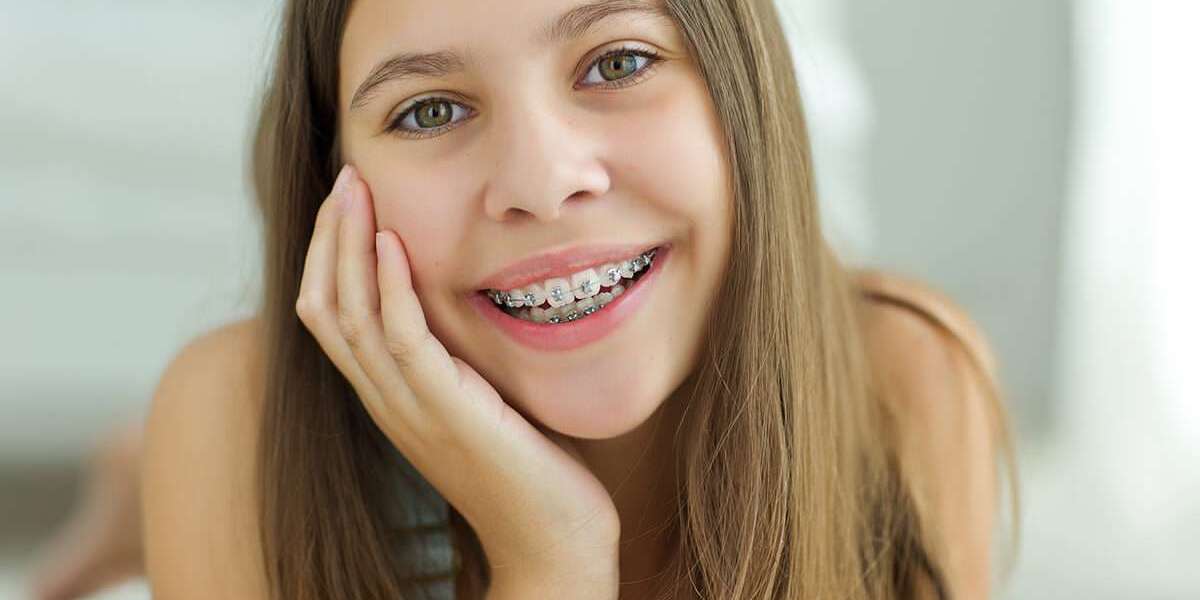 The Best Oral Care Products for People With Dental Braces