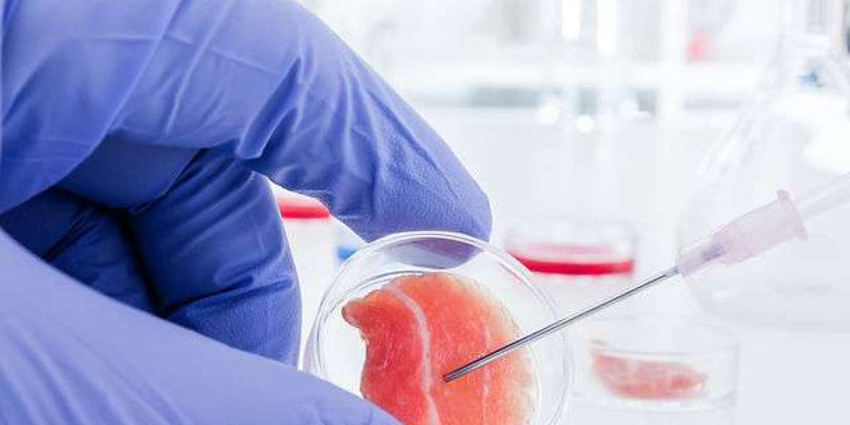 How Is Stem Cell Therapy Administered in Dubai Clinics?