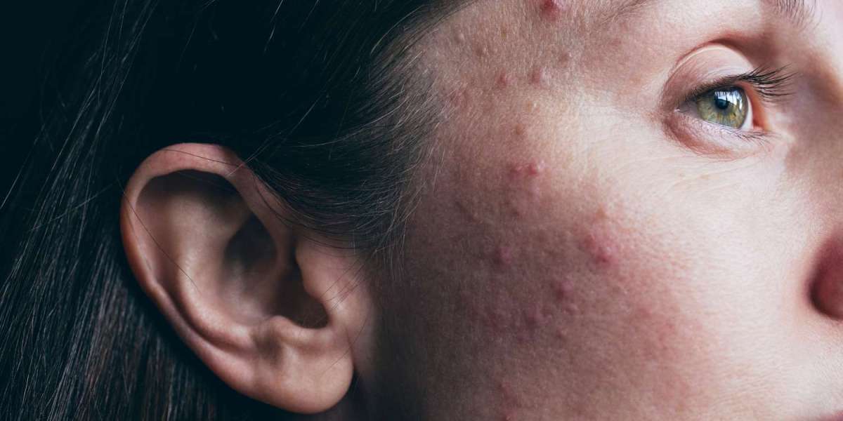 Why Do My Skin Conditions Keep Reappearing in Dubai?