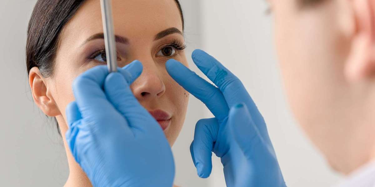 Getting Rhinoplasty Before Wedding Season in Islamabad