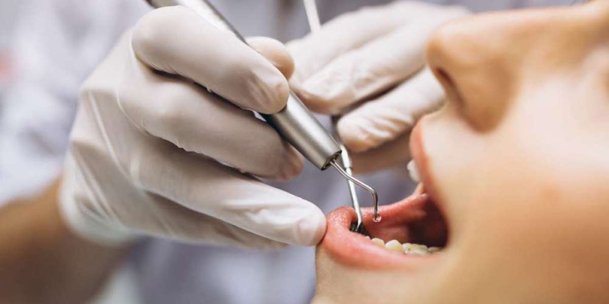 When Pregnant Women Need Tooth Extractions: What to Expect