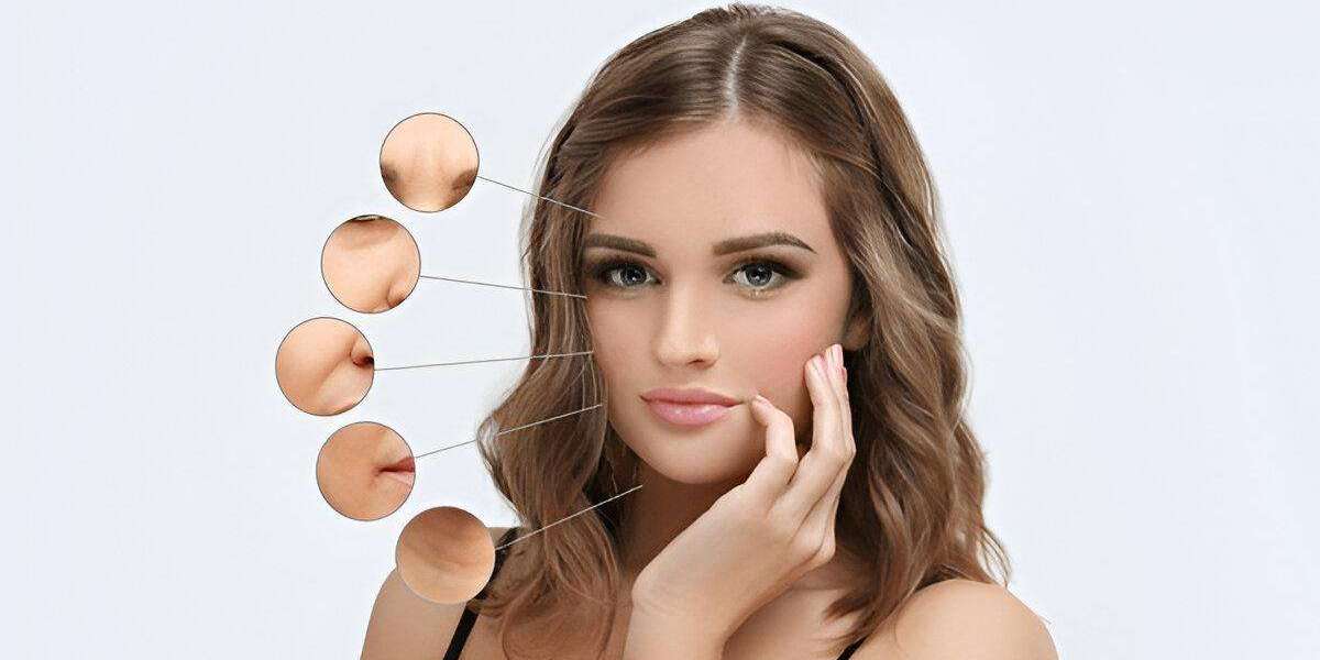 The Role of Hyaluronic Acid in Dermal Fillers