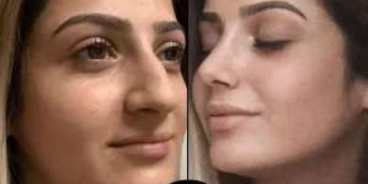 My Life-Changing Experience with the Best Plastic Surgeon in Dubai