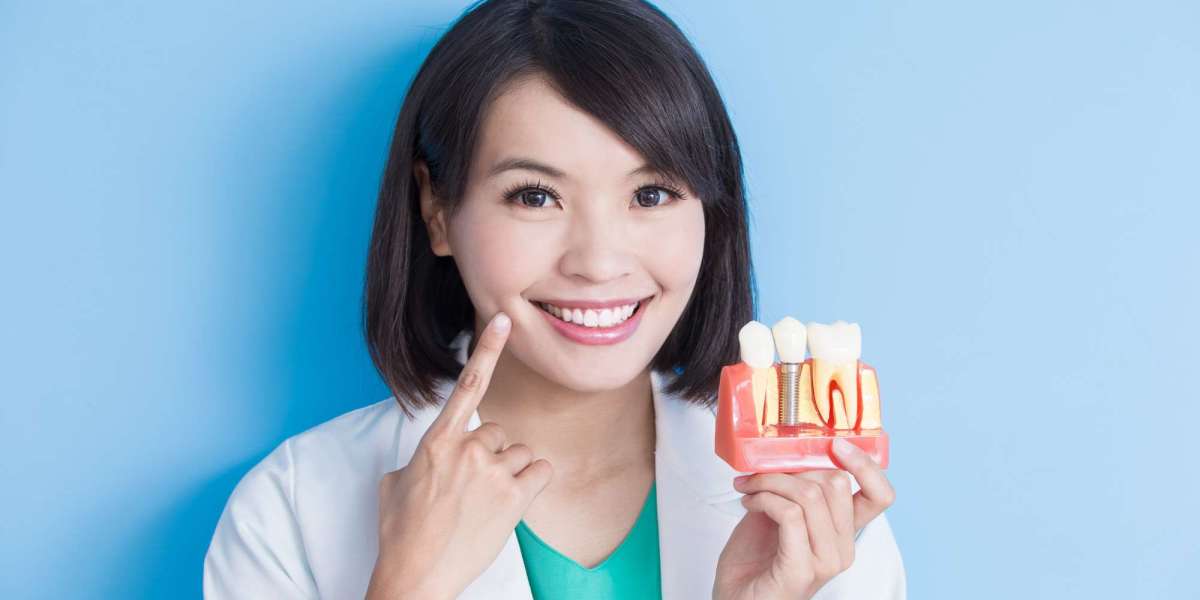 Myths and Facts About Dental Implants Debunked