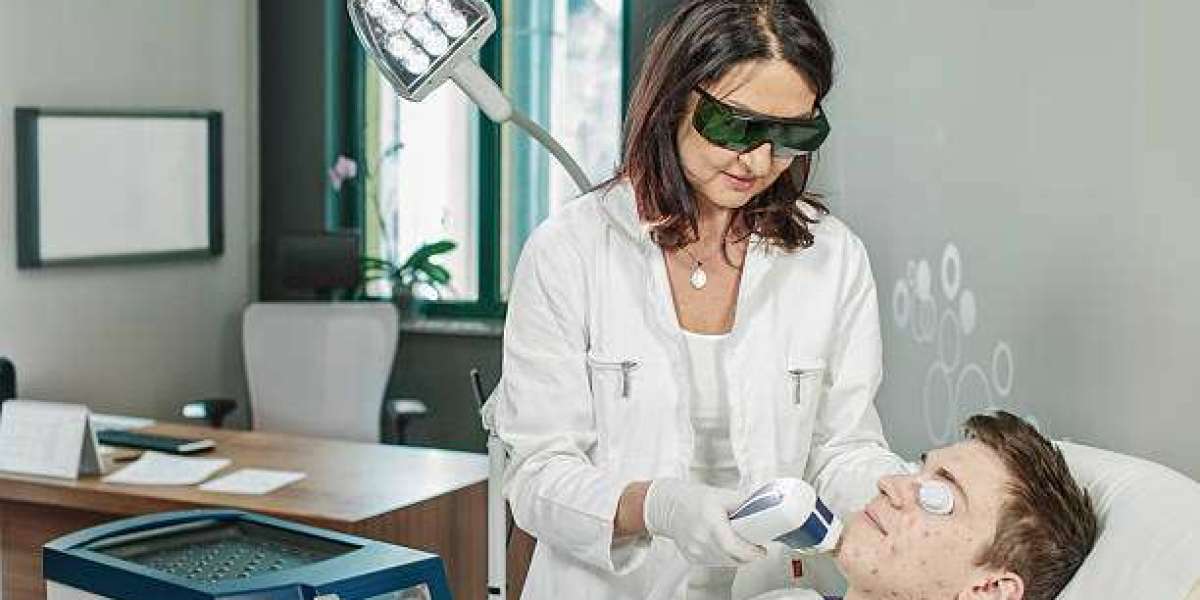 Chemical Peels for Acne Bellevue