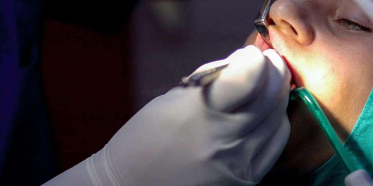 How Much Does Root Canal Treatment Cost