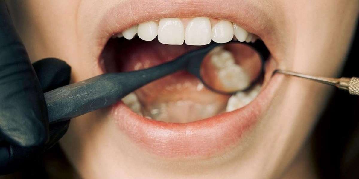 Tooth Extraction Recovery: Timeline, Tips, and What to Avoid