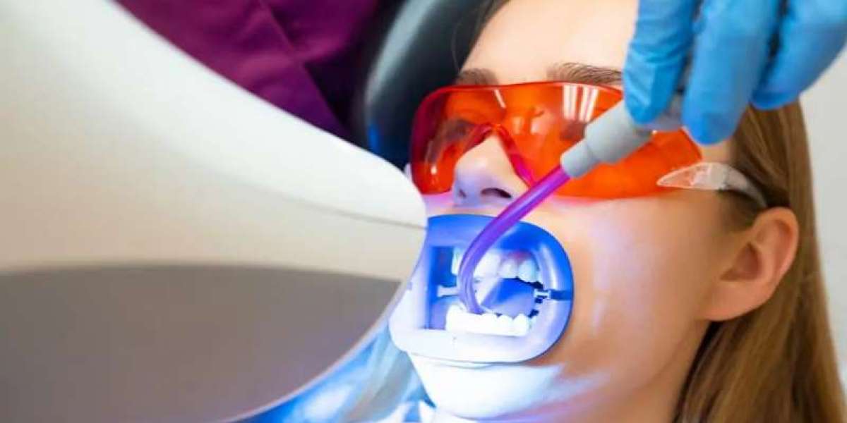 Expert Teeth Whitening in Al Ain | Darqoon Medical Center