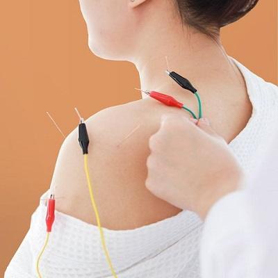 Acupuncture Treatment in Islamabad | ERC