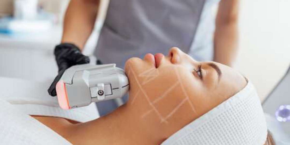Budget-Friendly HIFU Facial Treatment in Islamabad
