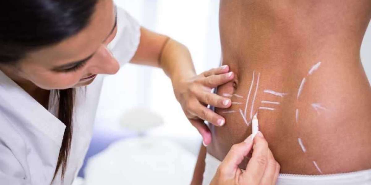 Liposculpture in Islamabad: Cost, Safety, and Results