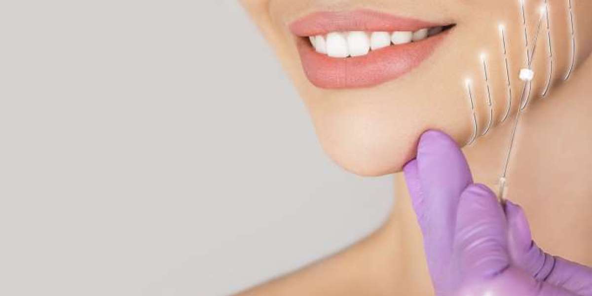 Tips to Find Affordable Thread Lift in Islamabad