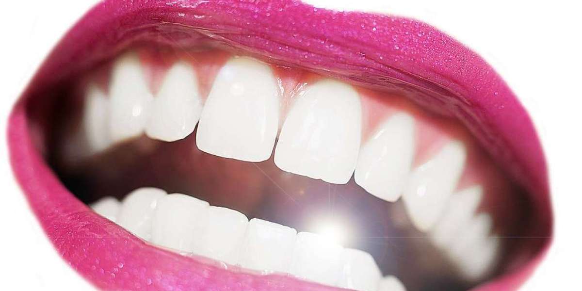 How to Maintain a Whiter Smile After Treatment
