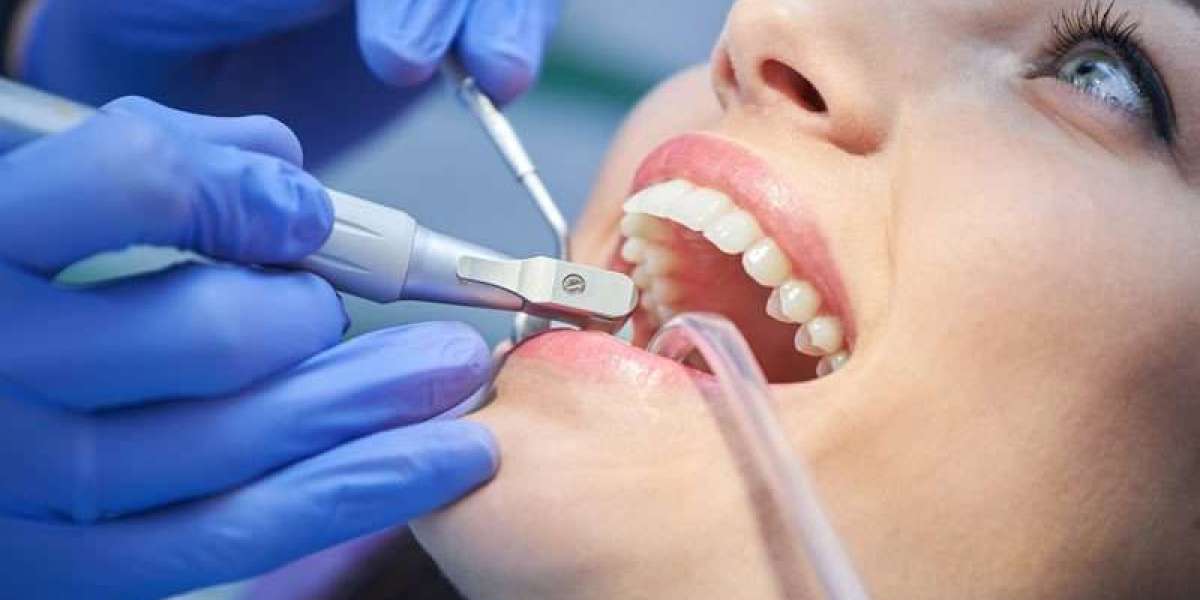The Science Behind Teeth Scaling: Removing Plaque and Tartar