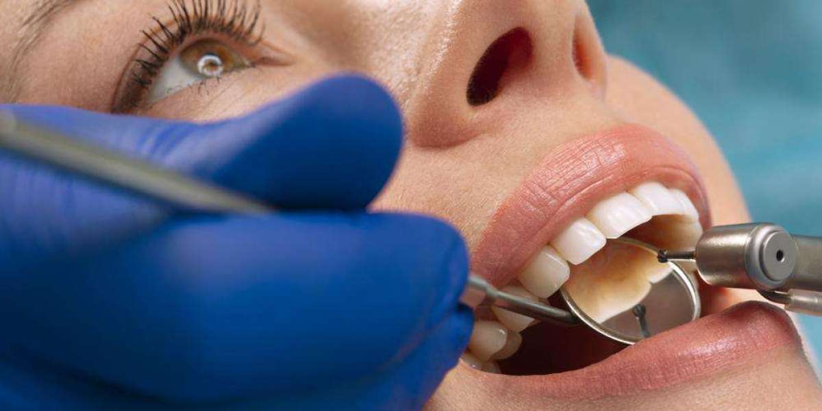 Dental Fillings for Teens: A Parent’s Guide to Oral Health