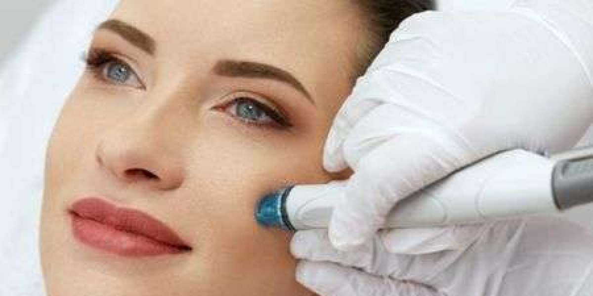 Is Laser Facial Treatment in Dubai Suitable for Men?