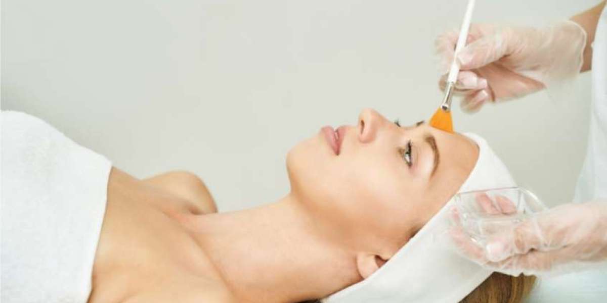 Expert Advice on Chemical Peels in Islamabad
