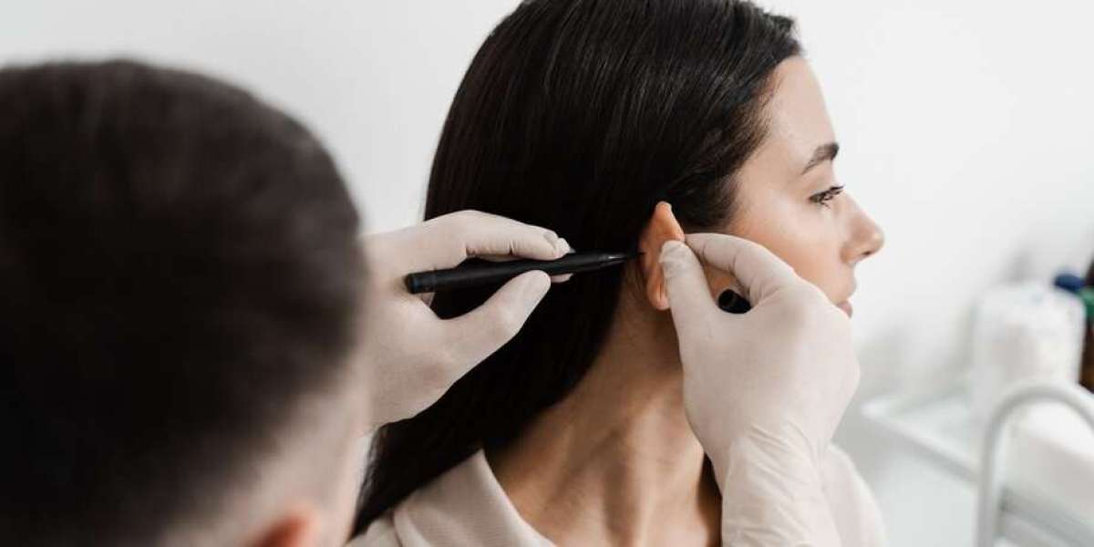 Step-by-Step Breakdown of the Ear Pinning Procedure in Islamabad