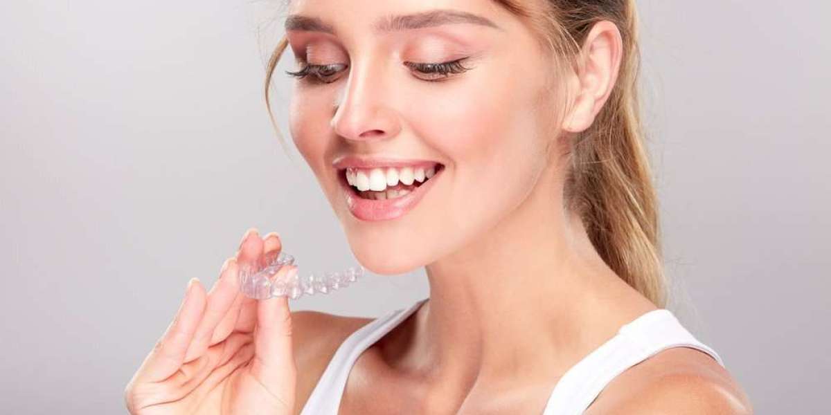 Invisible Aligners: Modern Orthodontics for Adults