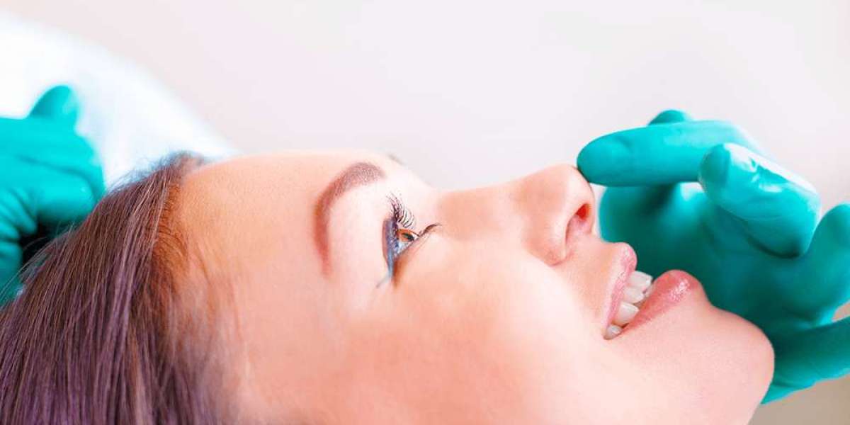 Allergan Botox for Jawline Slimming: What You Need to Know